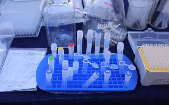 Capped microcentrifuge tubes standing in a blue laboratory rack, with pipette tips and glassware behind them